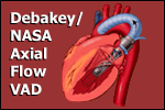 heart valve NASA Debakey