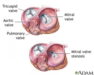 heart valve diagram 2