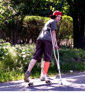 disabled Skateboard-cast-broken_leg-690475-l